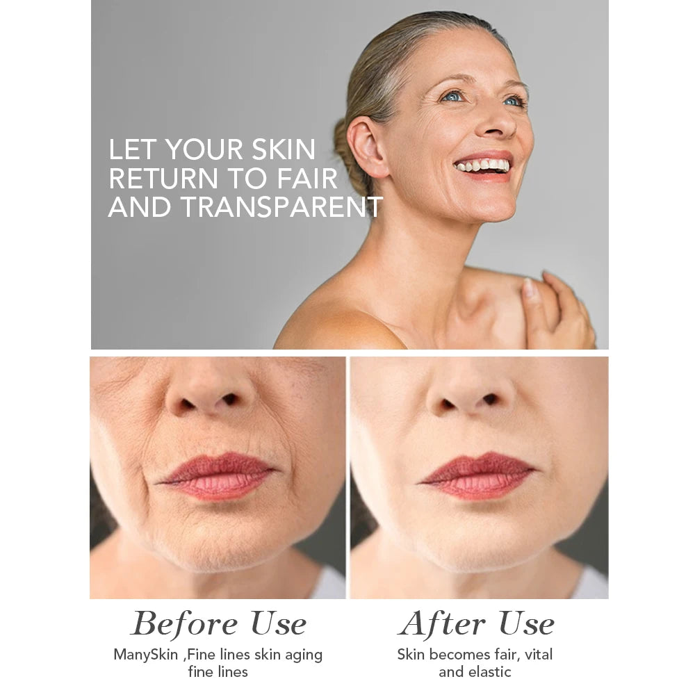 AILKE Face Cream With Hyaluron Scars Whitening Moisturizing Lifting Anti-aging Women Sleeping Dry Korean Bleaching Skin Care