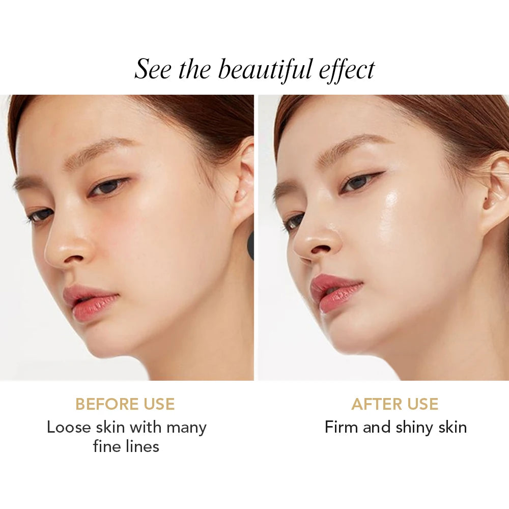 AILKE Face Cream With Hyaluron Scars Whitening Moisturizing Lifting Anti-aging Women Sleeping Dry Korean Bleaching Skin Care