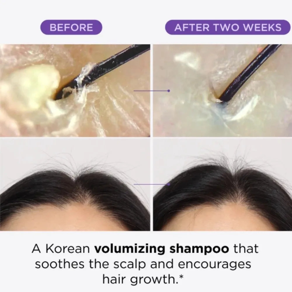 Dr. Groot Scalp Revitalizing Solution Hair Care Set Korean Brand 385ml Purifying Clay Shampoo 250ml Hair Thickening Conditioner