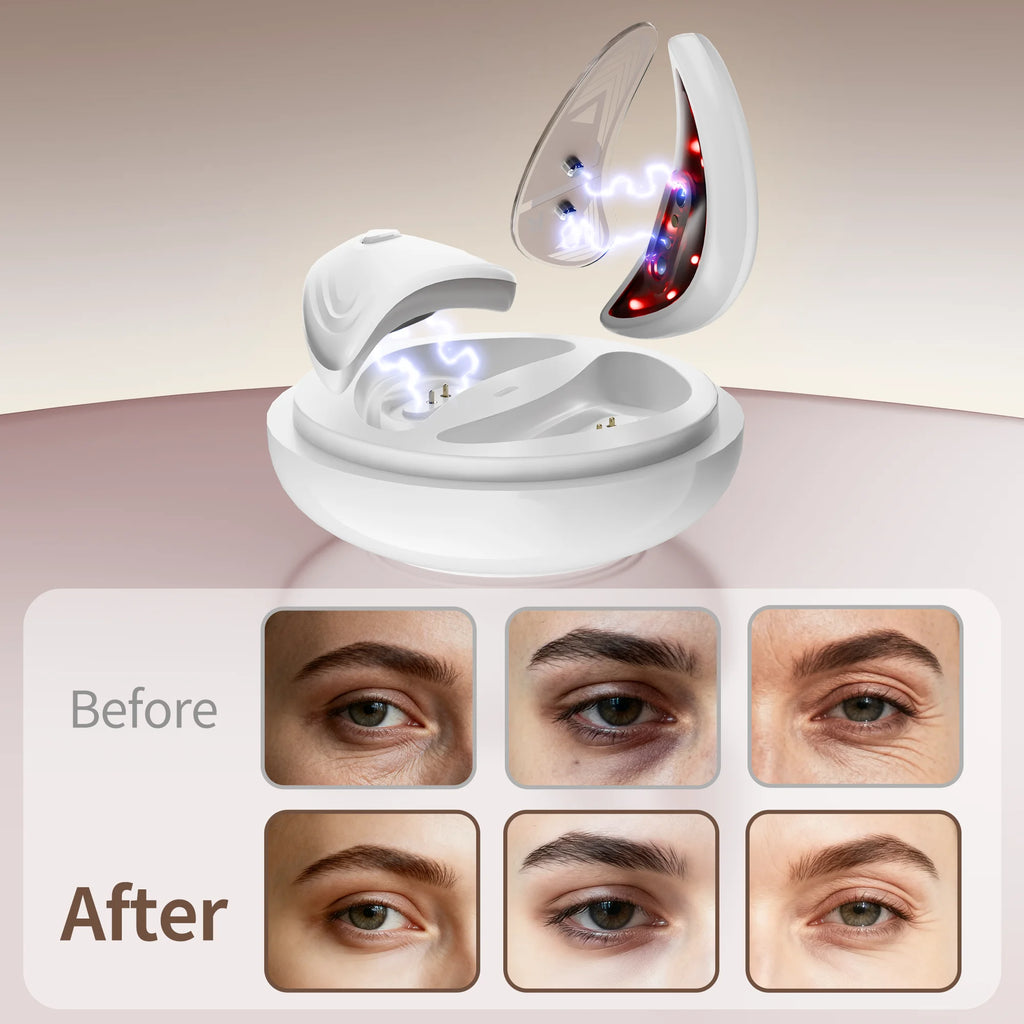 EMS Redlight Eye Massage and Stainless Steel Cooling Eye Pad Eyes Beauty Device for Puffy Eyes Reduce Bags & Dark Circles