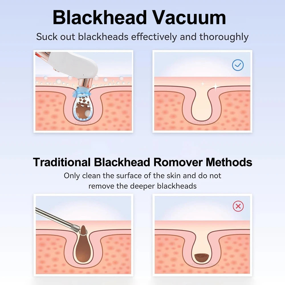 Blackhead Remover Pore Vacuum Cleaner Multifunctional Cleaning Instrument Small Bubble Facial Cleasing Machine Beauty Device