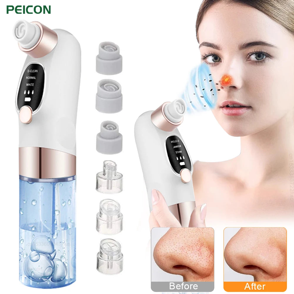 Blackhead Remover Pore Vacuum Cleaner Multifunctional Cleaning Instrument Small Bubble Facial Cleasing Machine Beauty Device