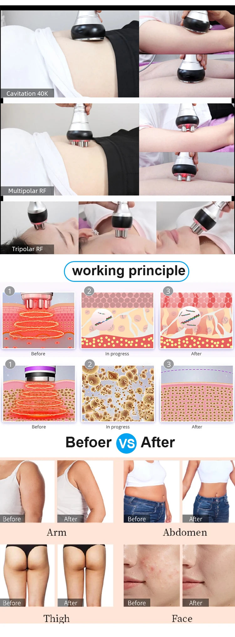 Nourishbel 3in1 Slimming Massage Cavitation Machine Multifunctional Equipment Facial Body Tightening Lifting Skincare Tool