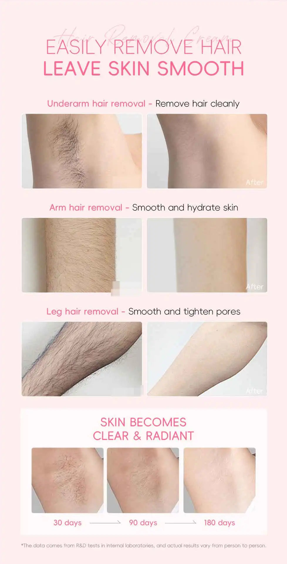 LAIKOU Hair Removal Cream  Intimate Areas Epilator Cream Painless Health Hair Remover Growth Inhibitor Men Woman Body Care 50g