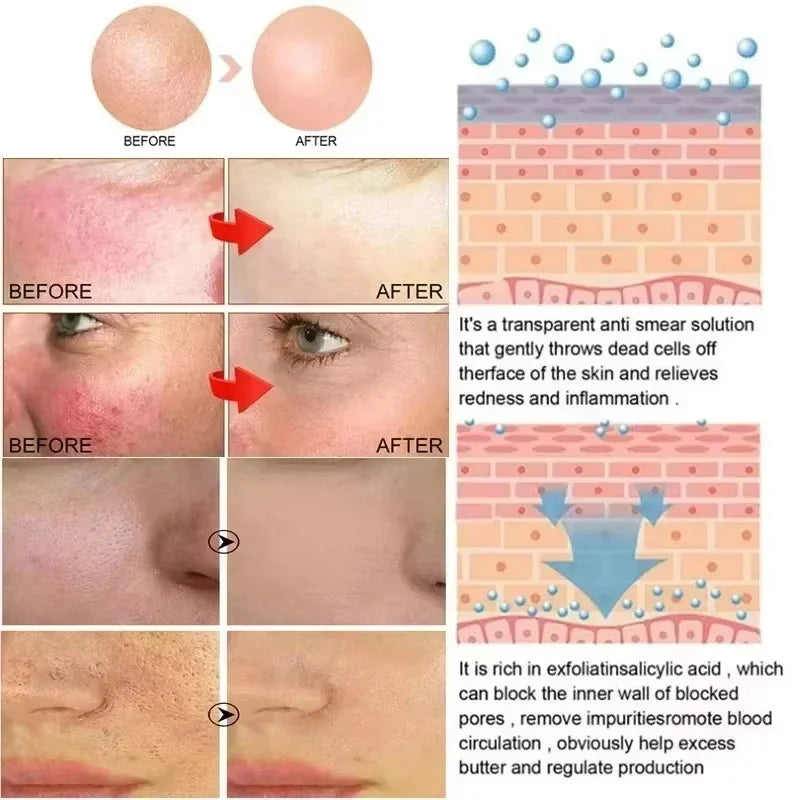 Facial Redness Repair Cream Improve Sensitive Muscles Acne Rosacea Dry&Itchy Skin Moisturizer Lotion Korean skincare products