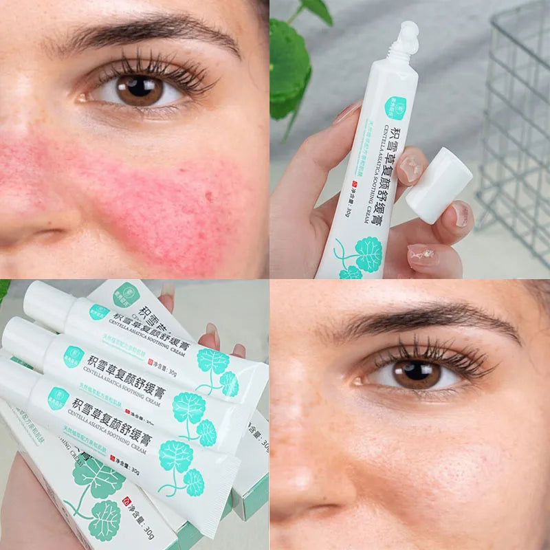 Facial Redness Repair Cream Improve Sensitive Muscles Acne Rosacea Dry&Itchy Skin Moisturizer Lotion Korean skincare products