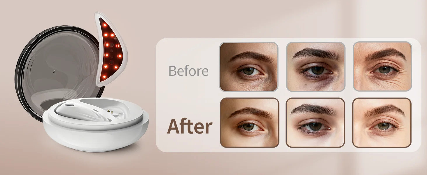 EMS Redlight Eye Massage and Stainless Steel Cooling Eye Pad Eyes Beauty Device for Puffy Eyes Reduce Bags & Dark Circles