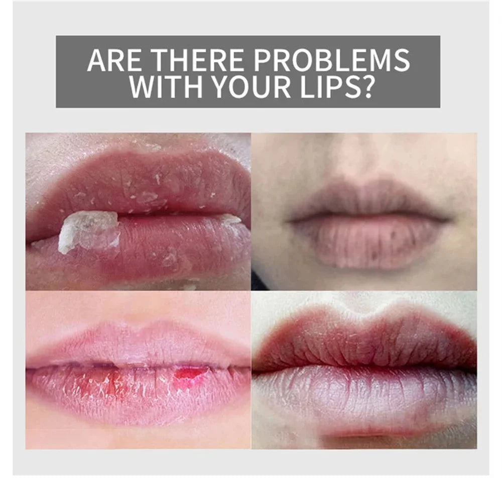 Lip Mask Repair Cracking Skin Treatment Exfoliating Remove Dark Lips Improve Dryness Lip Hydration Lightweight Nourishing Care