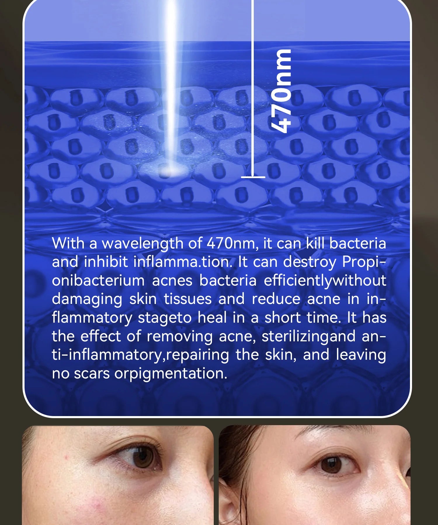 Hello Face Rechargeable Red Light Therapy Mask for Face & Neck  Infrared LED Mask Skincare Device for Glowing Skin