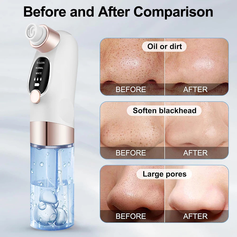 Blackhead Remover Pore Vacuum Cleaner Multifunctional Cleaning Instrument Small Bubble Facial Cleasing Machine Beauty Device